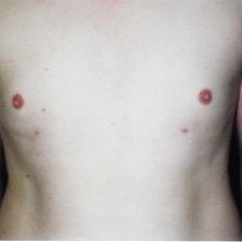 Chest After #6