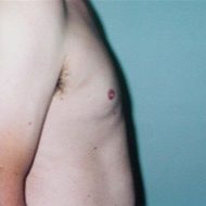 Chest After #7