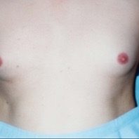 Chest Before #6