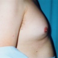 Chest Before #7