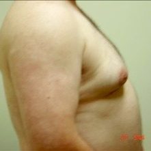 Chest Before #8