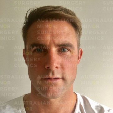 james_after
