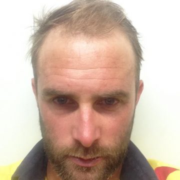 james_before