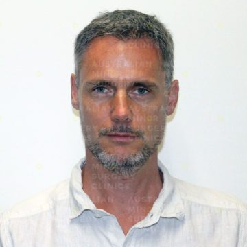 jorg_after